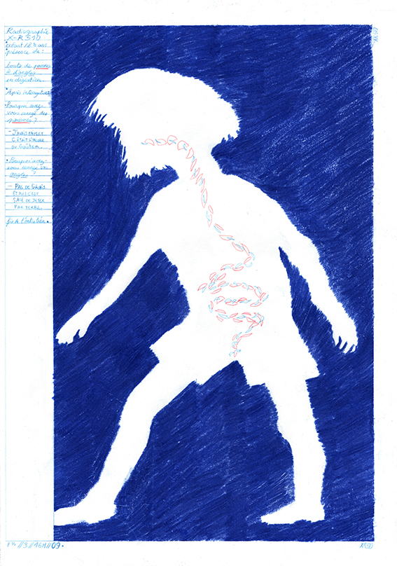 - Rognures d'ongles- page 2