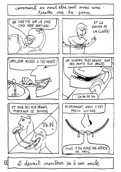 - La tirette sur la joue- page 3